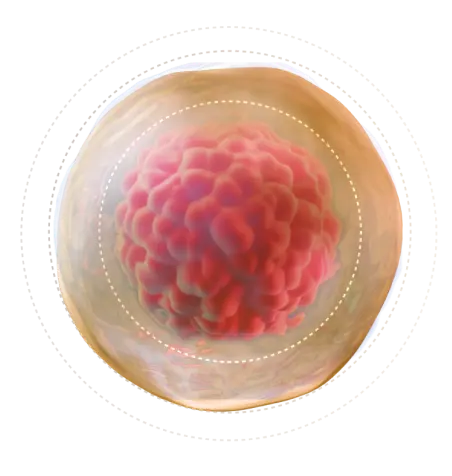 Inflammation